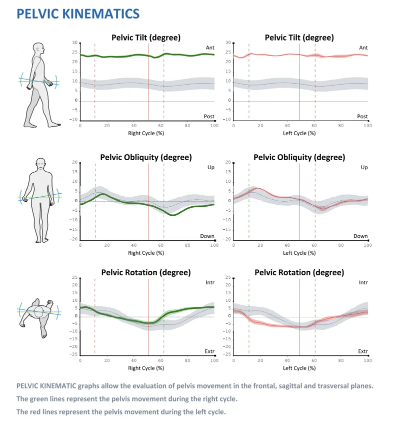 Pelvic tilt, obliquity and rotation across the right and left gait cycle, against the normative range